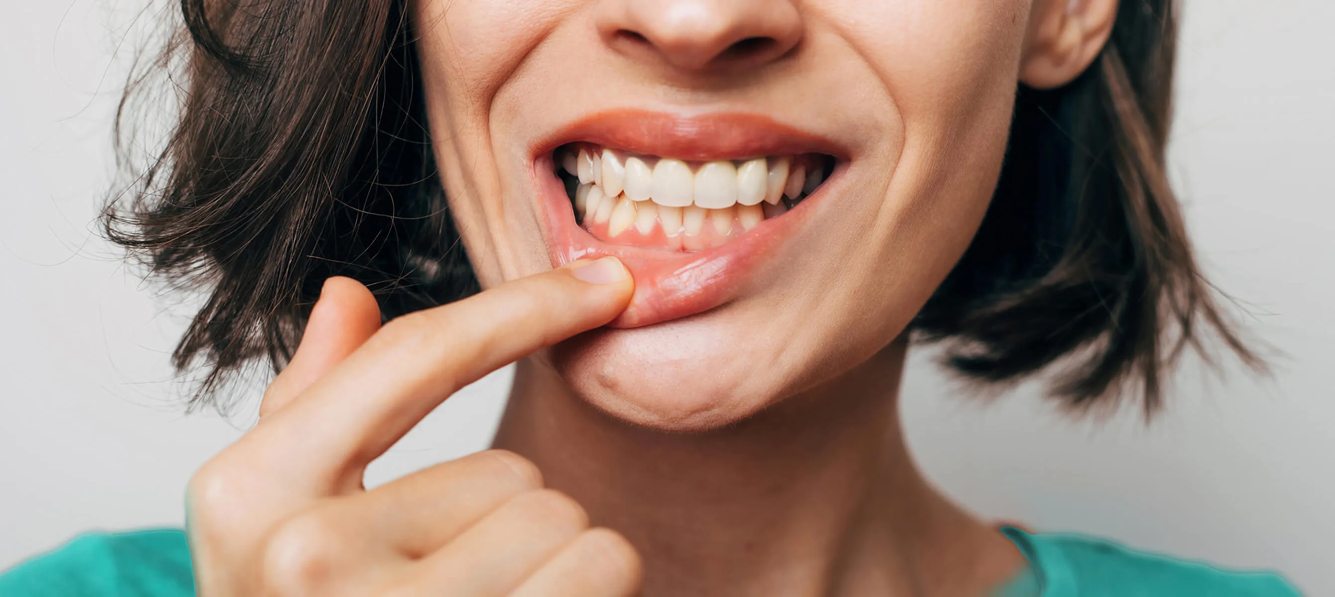 Лечение кариеса без стоматолога: возможно ли это